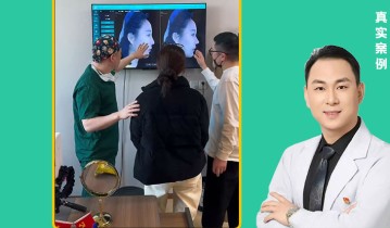 朱萌医生3D建模灵动鼻设计｜真人模拟+排队面诊流程大公开
